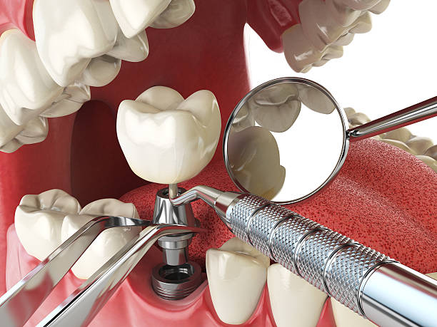 Best Emergency Gum Treatment in Harvey, MI